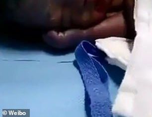 Este bebé fue hallado en la basura de un hospital chino.