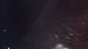 Lo que sería una revisión de rutina se convirtió en un hecho que nunca olvidarán.