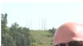 Chris Prater pensó que se trataba de solo una irritación ocular.