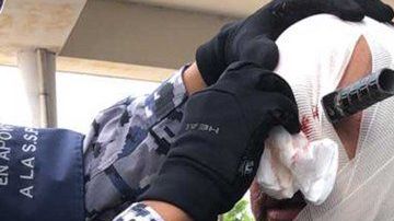 Herido con cuchillo por un lugar de estacionamiento