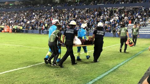 El capitán del Flamengo salió en camilla después de la espeluznante lesión.