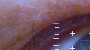 lasers-495751_960_720