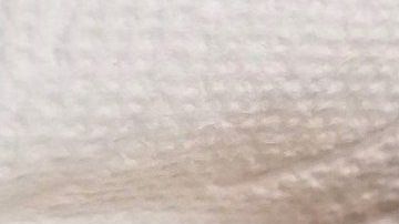 Pajarito herido fue llevado en Uber al veterinario.