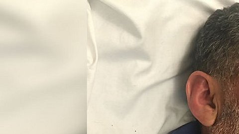 Rangel tras la brutal paliza