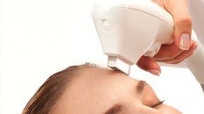 rejuvenecimiento-facial