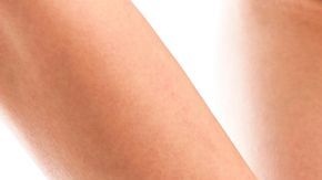 El consumo de alcohol y tabaco son agentes que promueven la aparición de celulitis.