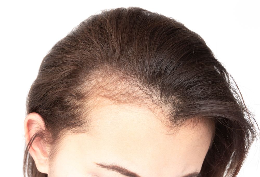 ¿Cómo mejorar un cuero cabelludo seco? El Diario NY