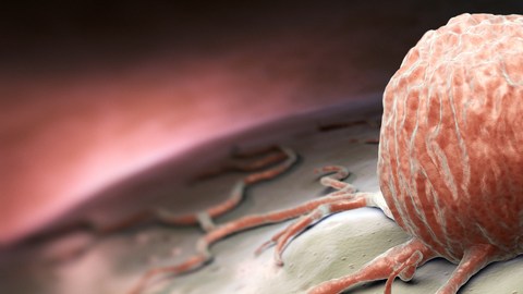 celula cancer