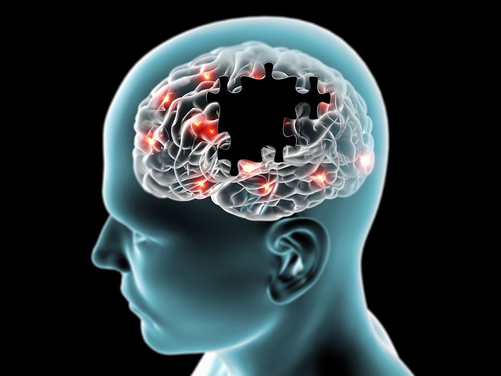 ¿Cuáles son los síntomas de los tumores cerebrales en adultos?