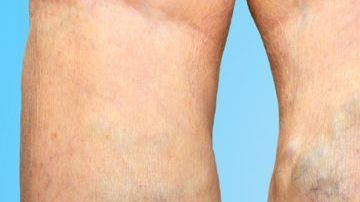 shutterstock_734490547