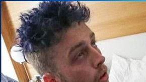 Los jóvenes le abrían arrebatado el bolso a un traficante supuestamente por engañarles.