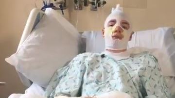 El joven sufrió quemaduras hasta de 4° grado.