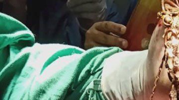 Una mujer come joyas y enferma gravemente.