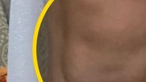 Las rodillas de Beth parecen dos caras de bebé.