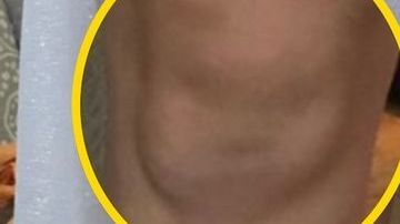 Las rodillas de Beth parecen dos caras de bebé.