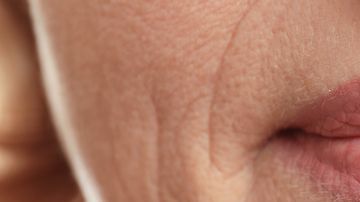 arrugas-en-los-labios