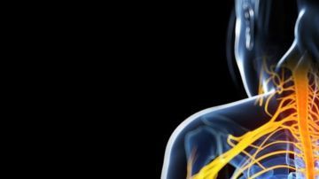 Arteriosclerosis_89930220_msbody