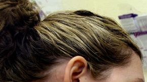 Medi-Cal es la versión estatal de Medicaid.