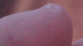 suplementos