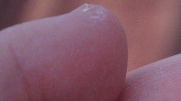 suplementos