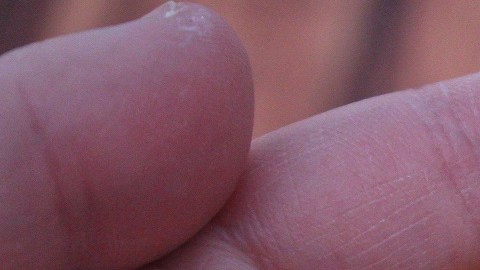 suplementos