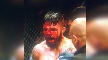 Perry recibió un rodillazo al rostro en su pelea contra VIcente Luque