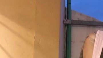 Así luce esta joven de 24 años adicta a la cirugía plástica.