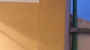 Así luce esta joven de 24 años adicta a la cirugía plástica.