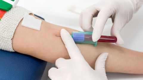Esta prueba permite predecir con un 83% de exactitud si la persona en cuestión se mantendrá viva o morirá.