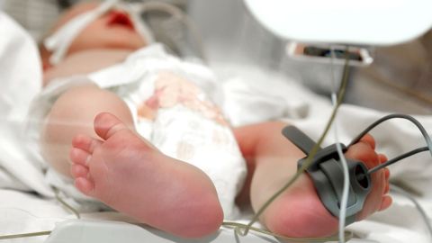 El bebé murió en el hospital.