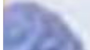 La esposa de Fernando Colina denunció negligencia médica en el tratamiento del cantante de “Sopa de caracol”.