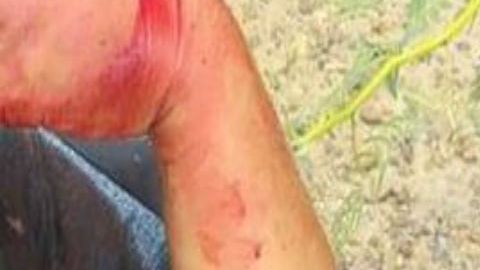 VIDEO Cartel del Noreste le destroza brazo a mujer polica en balacera en la frontera