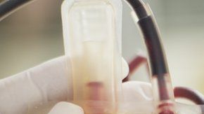 ¿Cuántos grupos sanguíneos dirías que existen?