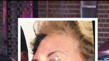 Gilda Lascano fue víctima de un chofer irresponsable