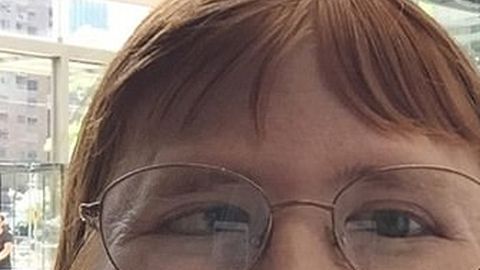 Melissa Blake responde a las críticas por su aspecto.
