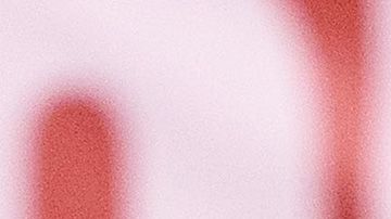 El jugador del PSV Eindhoven será intervenido quirúrgicamente el lunes