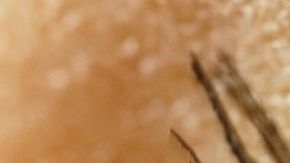 eye-4367141_1280