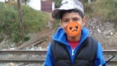 La Bacteria podría tener entre 13 a 15 años.