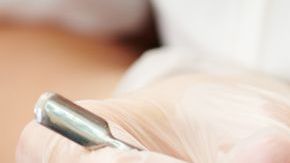 Lo mejor es ponerse en manos de un podólogo.