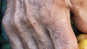 Los campesinos producen 80% de la comida en el mundo en desarrollo. A pesar de ello, son los más propensos a sufrir hambre.