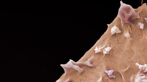 Los científicos están tratando de crear dicha enfermedad en un laboratorio.