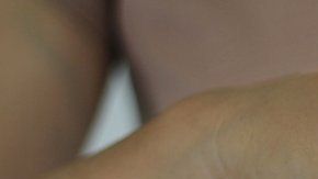 La psoriasis es una enfermedad inflamatoria crónica.