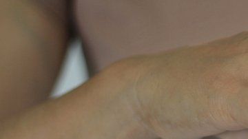 La psoriasis es una enfermedad inflamatoria crónica.