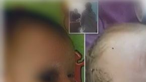 El pequeñito aún se encuentra delicado.