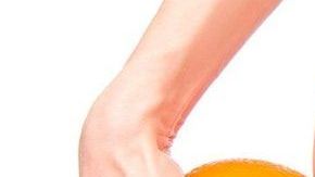 Las hormonas hacen que se presente más en mujeres que en hombres.