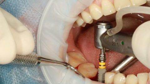 dental-3754769_1280