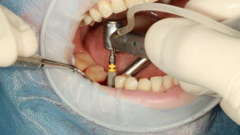 dental-3754769_1280