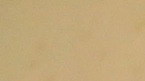 El estado de salud de La Parka está mejorando.