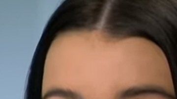 Mikayla Stutchbery casi queda ciega por los implantes labiales.