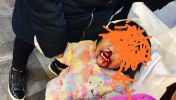 El incidente se reportó en la estación Candelaria, de la Línea 1.